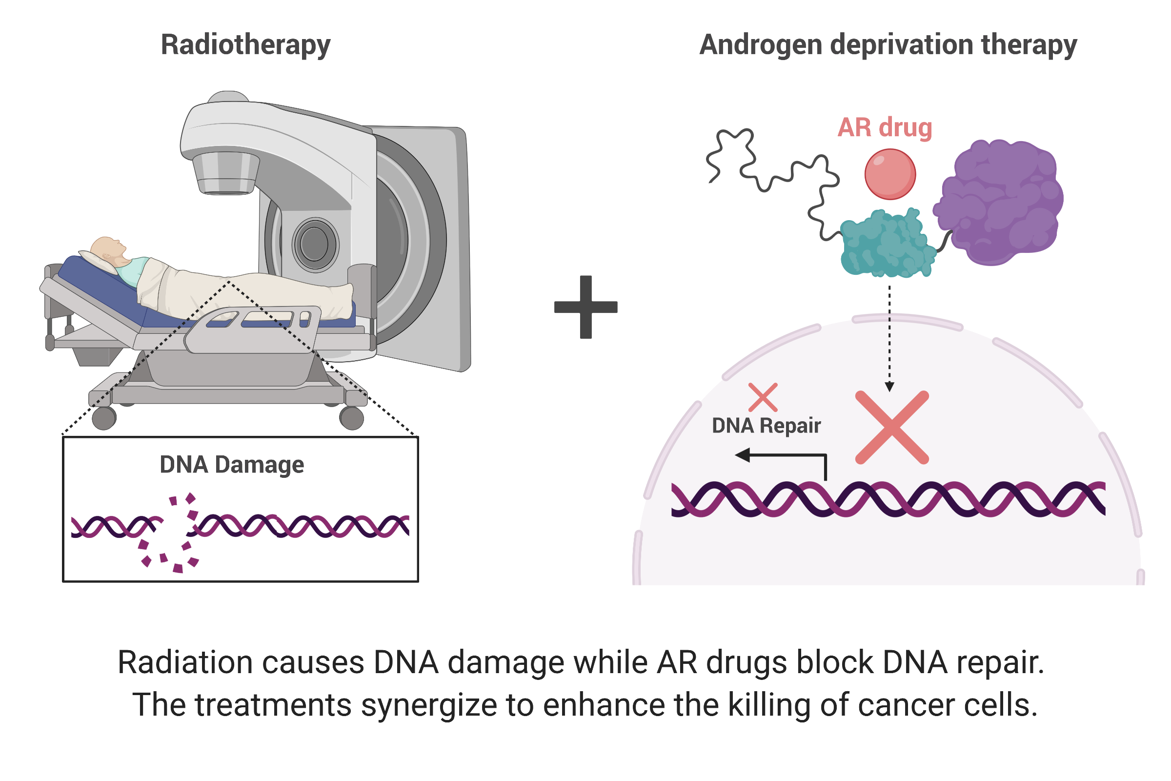 radiotherapy